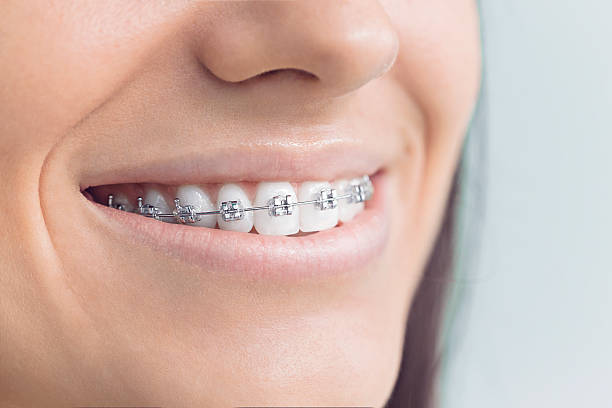 Best Teeth Whitening  in Santa Fe, TX